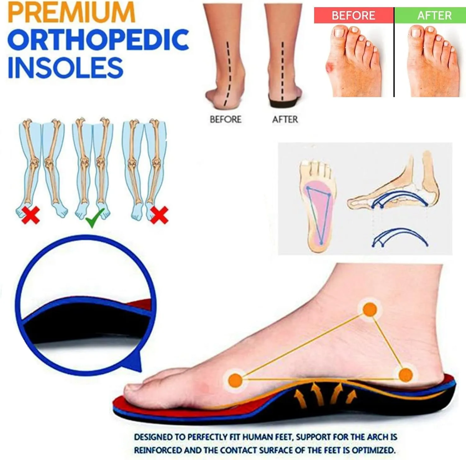 Orthopedic Sandals for Women Summer Comfort Walking Flats Cutout Design Adjustable Casual Slingback Shoes